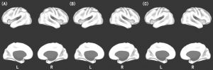 图10-2 社会影响激活相关脑区