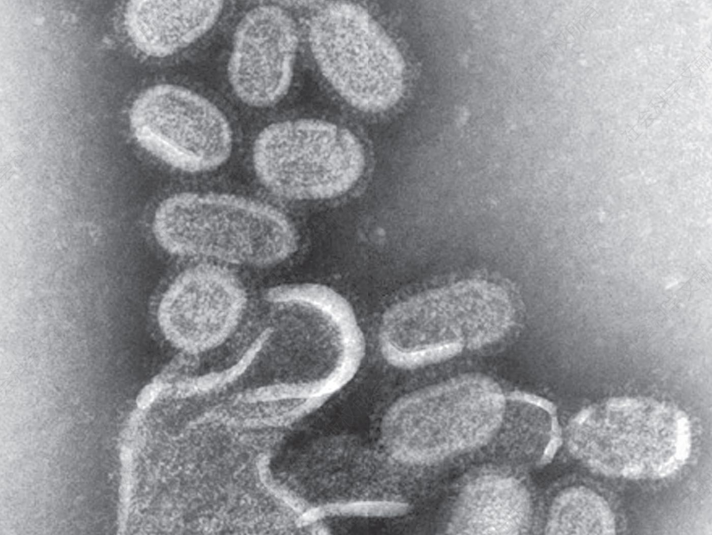 再造的1918年流感病毒的电子显微照片。