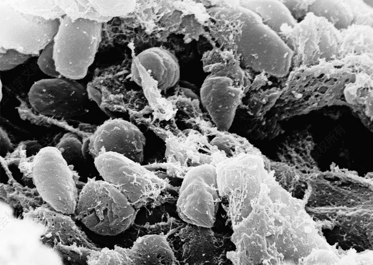 扫描电子显微照片展示了鼠疫耶尔森菌群——造成鼠疫的病因（落基山实验室，NIAID，NIH）