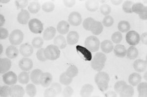 一个被人类红细胞包围的疟原虫（新月形）（美国疾病预防与控制中心）