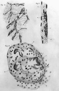 罗伯特·科赫的《创伤感染病的病因学调查》中的细菌插图，1880年。（美国国会图书馆）