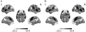 图2 左侧（A）和右侧（B）背侧脑岛静息态功能连接
