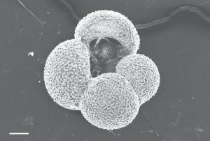 图29 泡状抱球虫（Globigerina bulloides）